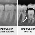 Dentistas digitales en México: planificación 3D para implantes más precisos y mejor diagnóstico